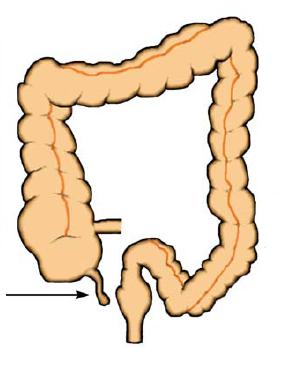 Human appendix