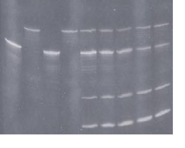 12% Polyacrylamide Gel showing: Lane 1- ribozyme RNA; Lane 2- target RNA; Lanes 4-7- Time course of ribozyme digestion of target RNA 